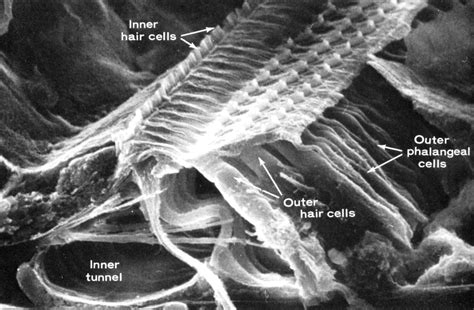 Electron Micrograph