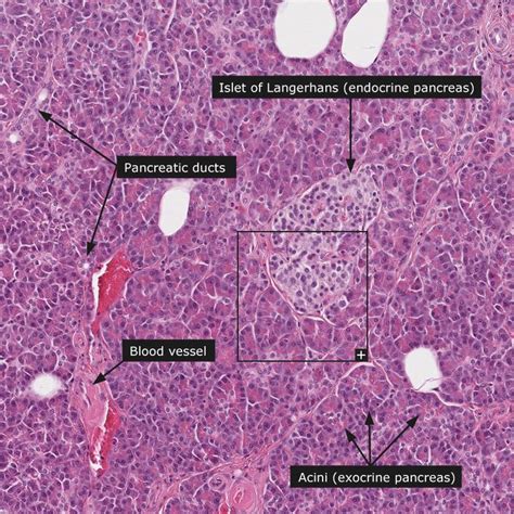 Corte De Pancreas Histologia