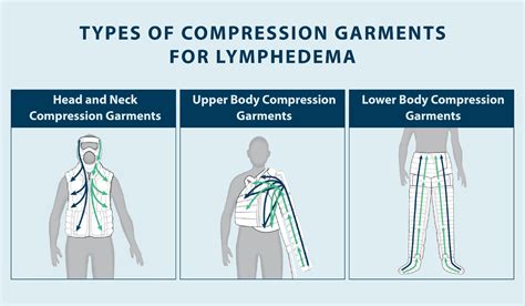 Should I Use Compression Garments for Lymphedema? - Tactile Medical