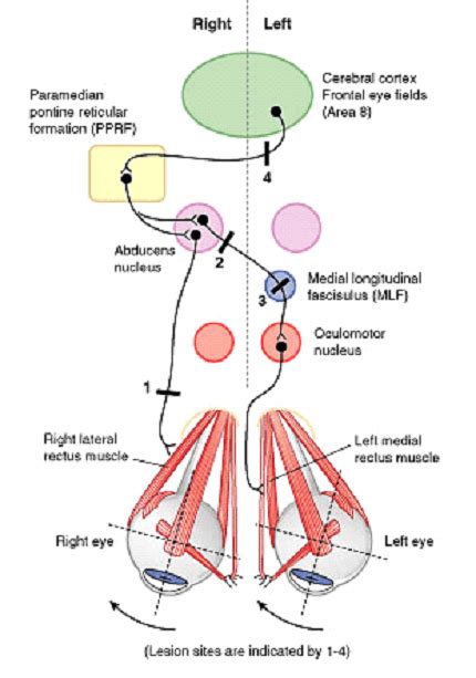 Horizontal Conjugate Gaze Pathway | Epomedicine