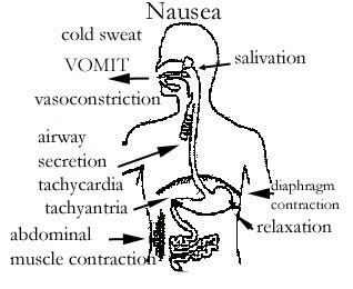 Treatment of Emesis (vomiting)