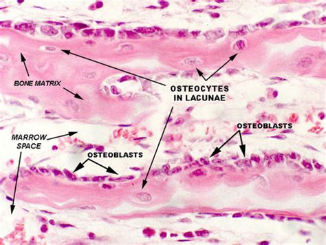 Histology 2 Bone Flashcards | Quizlet