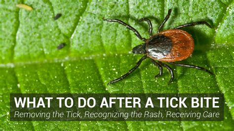 What to do after a tick bite | Johns Hopkins Lyme Disease Center