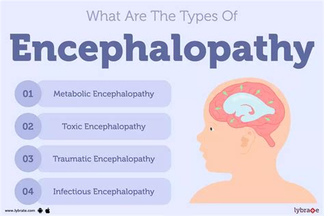 Encephalopathy: Treatment, Procedure, Cost, Recovery, Side Effects And More