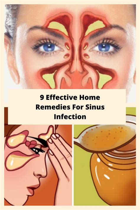 9 Effective Home Remedies For Sinus Infection