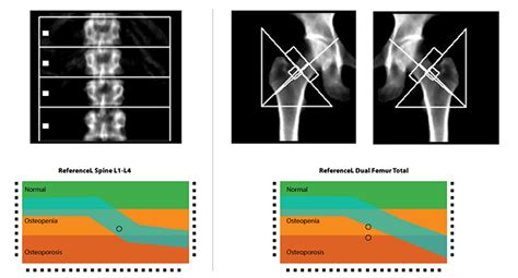 DEXA Scan: Everything You Need (& Want) to Know