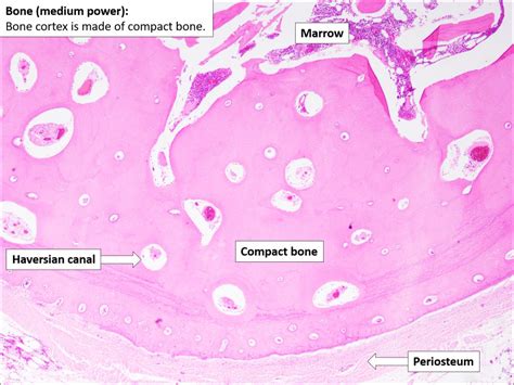 Bone – Normal Histology – NUS Pathweb :: NUS Pathweb