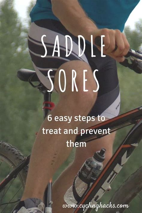 Treat and Prevent Saddle Sores: 6 Simple Remedies | Cycling workout ...