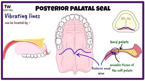 Posterior Palatal Seal Area Anatomy