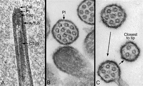 Electron microscopy of efferent ductule cilia. A.Higher magnification ...