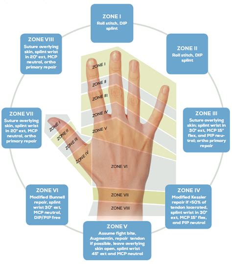 Management of Extensor Tendon Lacerations - Emergency Medicine Kenya ...