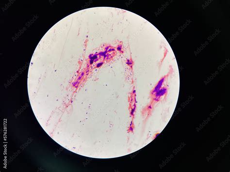 Bacteria cell in sputum sample Gram stain method. Stock Photo | Adobe Stock