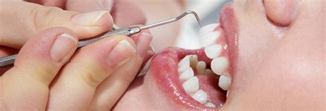 Best Teeth Cleaning Near Me | Affordable Teeth Clean Cost