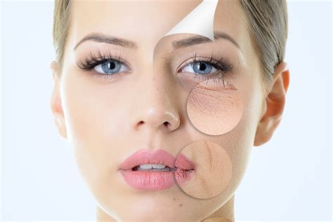 Fine Lines & Wrinkle Reduction - Apex Medical Spa