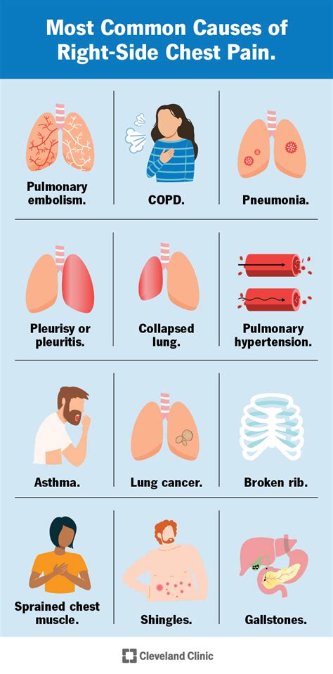 12 Causes of Right-Sided Chest Pain