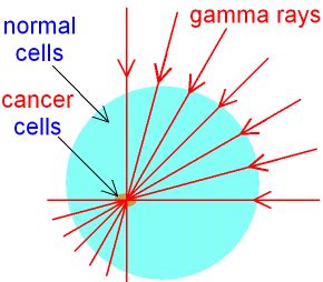 GCSE PHYSICS - What are Gamma Rays? - How are Gamma Rays used to Treat ...