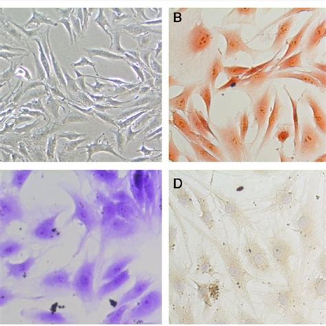 Identification of nucleus pulposus cells. A The gross morphology of the ...