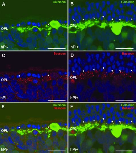 Horizontal cell synaptic contacts. Immunostaining for calbindin (green ...