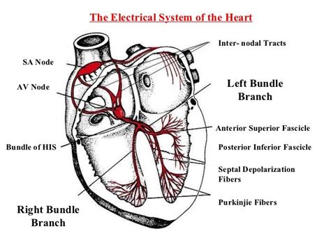 EKGs you don’t know: bifascicular block | SinaiEM