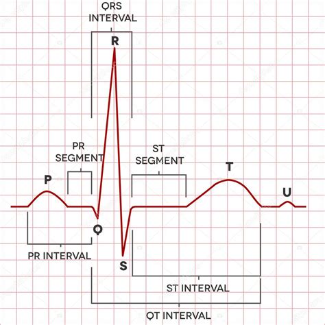 Corazón humano ritmo sinusal normal, electrocardiograma 2023