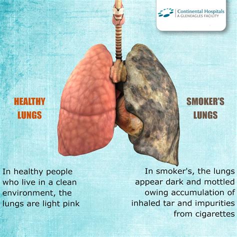 Non Smoker Lungs Vs Smoker