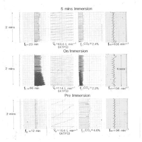 (PDF) Cold Water Immersion