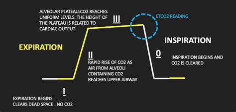 Capnography | Emergency Medicine Education | Resus