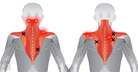 Areas Of The Back Muscles : Muscles Of The Back Teachmeanatomy / The ...