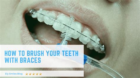 How To Brush Your Teeth With Braces - Ely Smiles