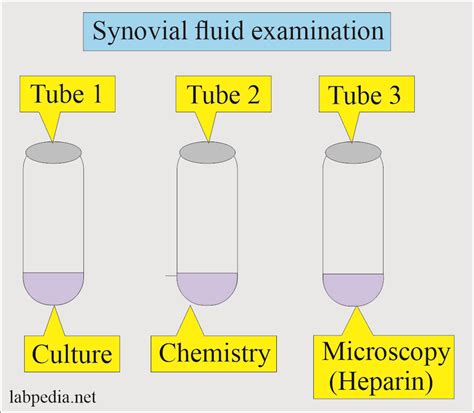 Synovial Fluid Analysis, Normal and Abnormal Arthrocentesis