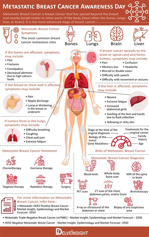 Metastatic Breast Cancer Infographic