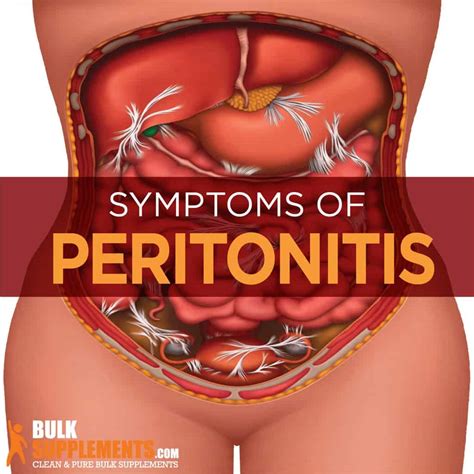 Peritonitis: Symptoms, Causes & Treatment