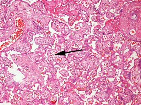 File:Placenta histology 005.jpg - Embryology