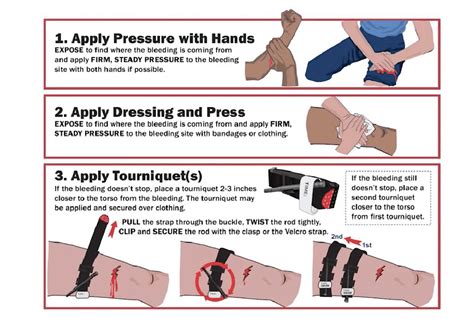 How To Apply A Tourniquet