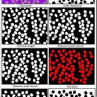 RBC counting and classification flow diagram. | Download Scientific Diagram