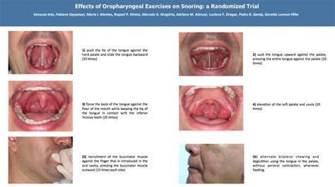 Mouth, Tongue Exercises Significantly Curb Snoring | Sleep Review