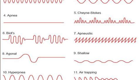 bradypnea Archives - HealthnPhysio