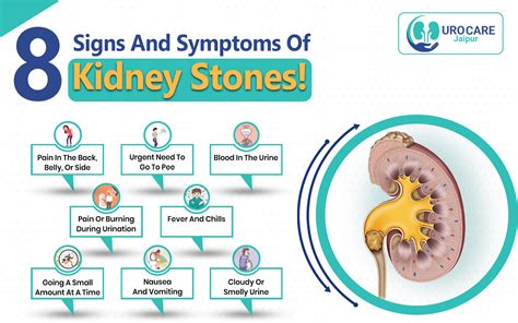 8 Signs and Symptoms of Kidney Stones!