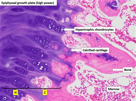 Bone – Normal Histology – NUS Pathweb :: NUS Pathweb