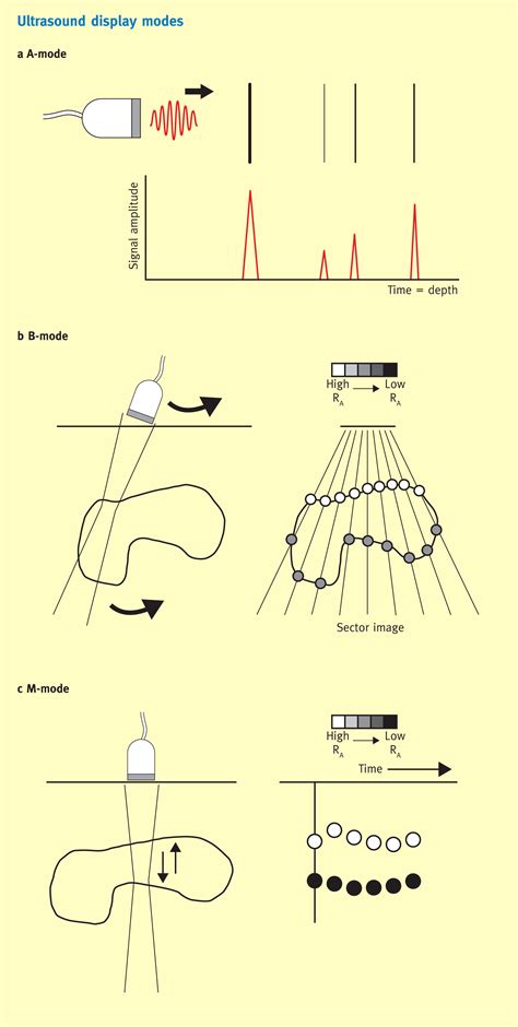 References in The physics of ultrasound - Anaesthesia & Intensive Care ...