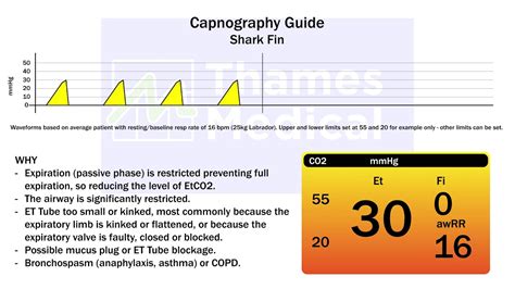 Capnography Guide: Shark Fin Waveform - Thames Medical Ltd.