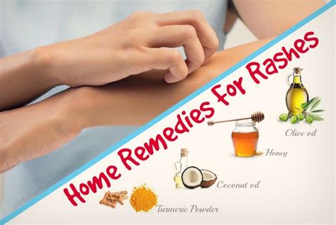 Top 24 Natural Home Remedies for Rashes on Body