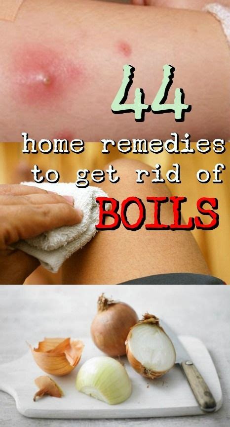 87 Best Armpit boils treatment at home for New Design | Ideas Home and ...