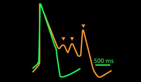 Cardiotoxicity and Safety | Axion Biosystems