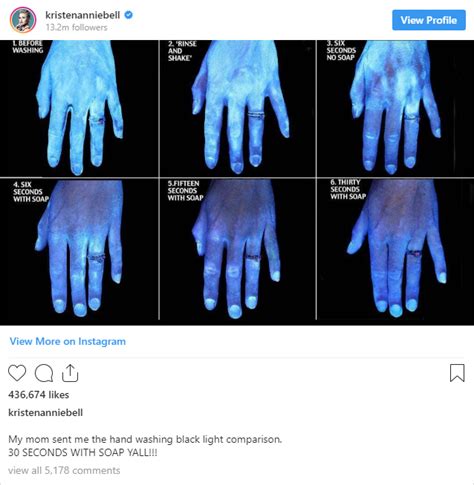 Hand Washing Vs Hand Sanitizer Experiment