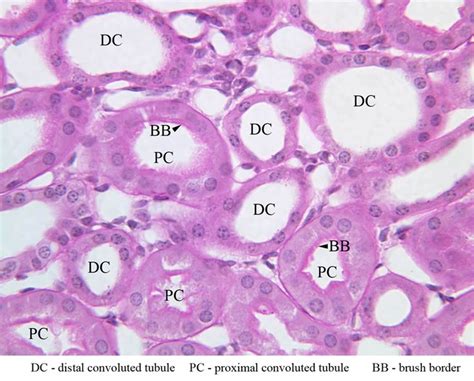 Histology - Kidney (cortex) DC - DCT PC - PCT BB - Brush border of ...