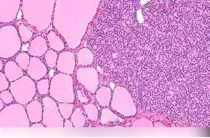 Thyroid and Parathyroid Histology Diagram | Quizlet