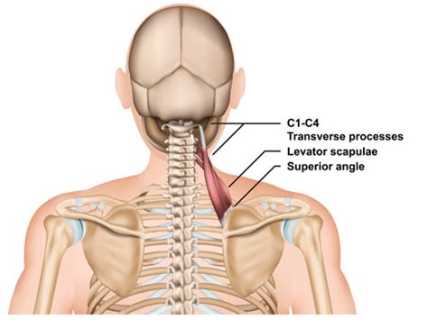 Treating Trigger Points in the Levator Scapulae | Dry Needling, Levator ...