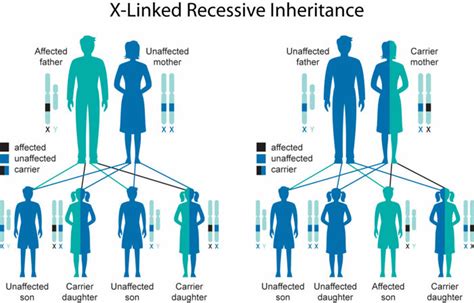 Leigh syndrome causes, symptoms, diagnosis, treatment & life expectancy