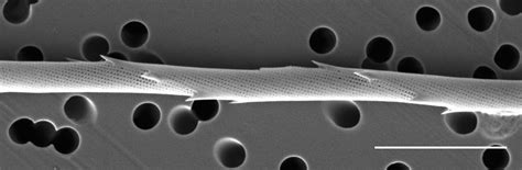 Image Chaetoceros-lauderi_ANSP_GCM5770_02.jpg | Species - Diatoms of ...